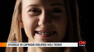 Uyumsuz ve Çapraşık Dişlerde Ortodonti Tedavisi - İşin Uzmanı CNN TÜRK