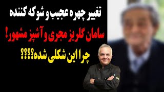 تغییر چهره عجیب و شوکه کننده سامان گلریز مجری و آشپز مشهور !چرا این شکلی شده؟؟؟؟