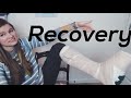 Bunion Surgery Recovery Process