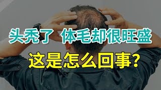 【脱发常识】头秃了，体毛却很旺盛，这是怎么回事？主要和激素有关！