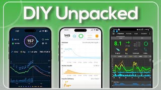 DIY Insulin Systems: Features & Controls Explained