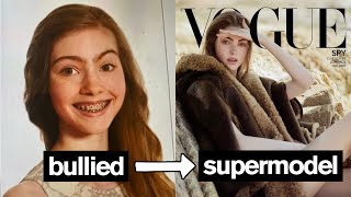 BULLIED TEENAGER BECOMES SUPERMODEL *Emotional*