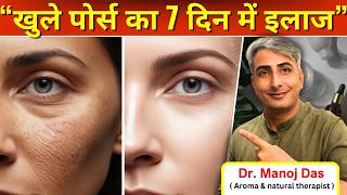 खुले पोर्स का 7 दिन में इलाज I चमकदार गोरी साफ़ त्वचा का सीक्रेट जानें I DR. MANOJ DAS #drmanojdas