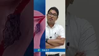 Uterus Removal Surgery / ആർക്കാണ് ഗർഭപാത്രം നീക്കം ചെയ്യേണ്ടത് ? #shorts #healthymallu #malayalam