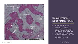 Orthobiologics and Bone Grafts In Foot and Ankle Surgery