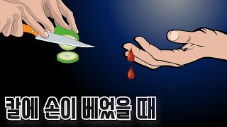 날카로운 칼에 살을 베었을 때 처치 방법 | 알면좋은정보