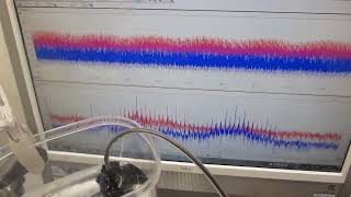 樹脂容器を利用した、メガヘルツの超音波システム－－超音波発振制御技術の応用ーー（超音波システム研究所）