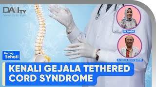 Tethered Cord Syndrome | Bincang Sehati