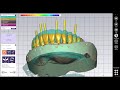 exocad design tutorial for screw retained bar design on ti base implant abutment with plovdiv 2.4