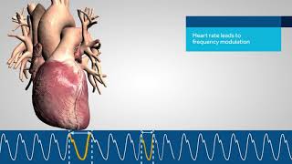 Nellcor PM1000N: Bedside Respiratory Patient Monitoring System Overview