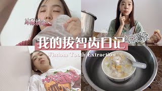 Vlog24｜拔完智齿痛了七天｜拔完智齿需要注意什么？What to pay attention to after wisdom tooth extraction？