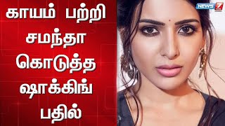 காயம் பற்றி சமந்தா கொடுத்த ஷாக்கிங் பதில் | samantha | injury