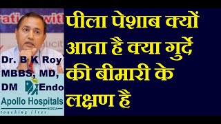 yellowish urine is it a sign of kidney disease | Pila peshab aane ki wajah | Pila peshab ka ilaj