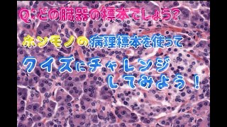 病理標本クイズ　どの臓器の標本でしょう？１問目