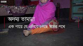 অদম্য তামান্না এক পায়ে এগিয়ে চলছে স্বপ্নের পথে