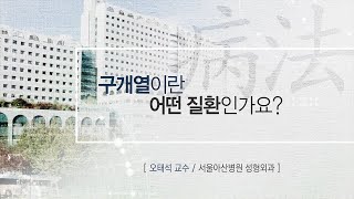 구개열이란 무엇인가요? [AMC 병법]