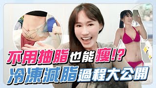 「冷凍減脂」全紀錄！產後瘦身就靠它，告別大肚腩！