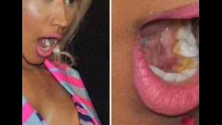 Nicki Minaj Descuidos Memorables 2016 Campilation