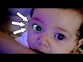 Help! There's Something Wrong With My Baby's Eye... | Dr. Paul