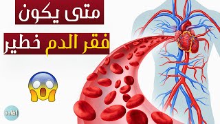 متى يكون فقر الدم خطير ؟