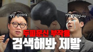 탈모엔 두피문신? 부작용 검색해본적 없는 사람은 말도 꺼내지마 | 그나마 있던 머리카락도 잃고싶지 않다면 | 탈모/두피문신/모발이식