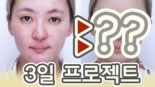 살아남아! 이 각박한 민감피부 권하는 세상에서!! feat.더마토리