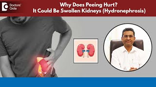 Pee not flowing freely?|Water in Kidney | Swollen #kidney|Hydronephrosis #urology-Dr.Girish Nelivigi