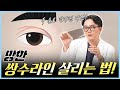 쌍수 했는데 라인이 왜 이래??? | 제이티성형외과 김진태원장