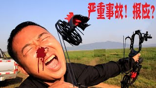 小伙试用能射钢珠的复合弓，发生严重后果损失惨重 Compound bow accident