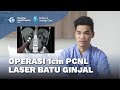 Operasi Batu Ginjal dengan Laser PCNL, Hancurkan Batu Ukuran 2 cm - dr. Maruto Harjanggi, Sp.U