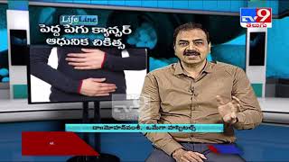 Colon cancer: Symptoms, treatment, and causes || LifeLine - TV9