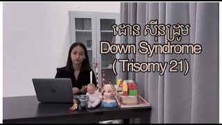 ដោន សុីនដ្រូម Down syndrome ( Trisomy21) រឺ កុមារខ្សោយសាច់ដុំនិង ខ្សោយប្រាជ្ញាពីកំណើត