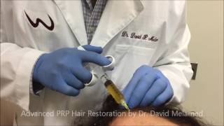 Hair Restoration with Advanced PRP