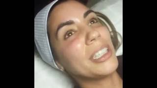 LIVE: Vampire Facial with Tanya Patron, PA-C