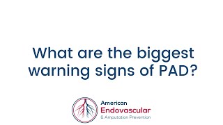 What are the biggest warning signs of PAD?