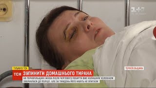 Поліція на Тернопільщині ігнорує регулярні побиття жінки її колишнім чоловіком