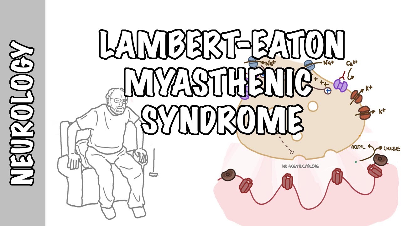 Lambert-Eaton Myasthenic Syndrome - Pathophysiology, Signs And Symptoms ...