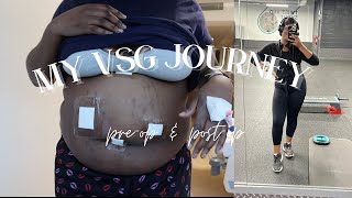 MY WEIGHTLOSS JOURNEY WITH GASTRIC SLEEVE SURGERY | PRE-OP & POST-OP DIARY & 40LBS WEIGHTLOSS | VSG