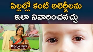 పిల్లల్లో కంటి అలెర్జీలను ఇలా  నివారించవచ్చు | allergic eyes | Arogya Vardhini Dr.Suchitha Challa