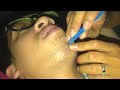 I PLUCKING FACIAL HAIRS for mr HTL ASMR