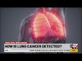 Lung cancer rates may be declining but not as officials expect