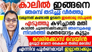 കാലിൽ ഇങ്ങനെ ഞരമ്പ് തടിച്ചു വീർത്തു വരുന്നത് കണ്ടാൽ ഉടനെ ഇതൊരു സ്പൂൺ എടുത്തു കഴിച്ചാൽ മതി|vericose