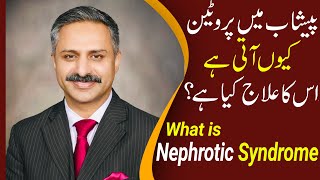 Nephrotic Syndrome \u0026 Protein or Blood in Urine? | Peshab ma protein ka ilaj