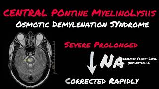 Central Pontine Myelinolysis || Osmotic Demylenation Syndrome || Symptoms || Causes || Management