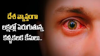 Conjunctivitis.. భయపెడుతున్న కళ్లకలక.. మహిళల్లో కన్నా పురుషుల శాతమే ఎక్కువ.. | Telugu OneIndia