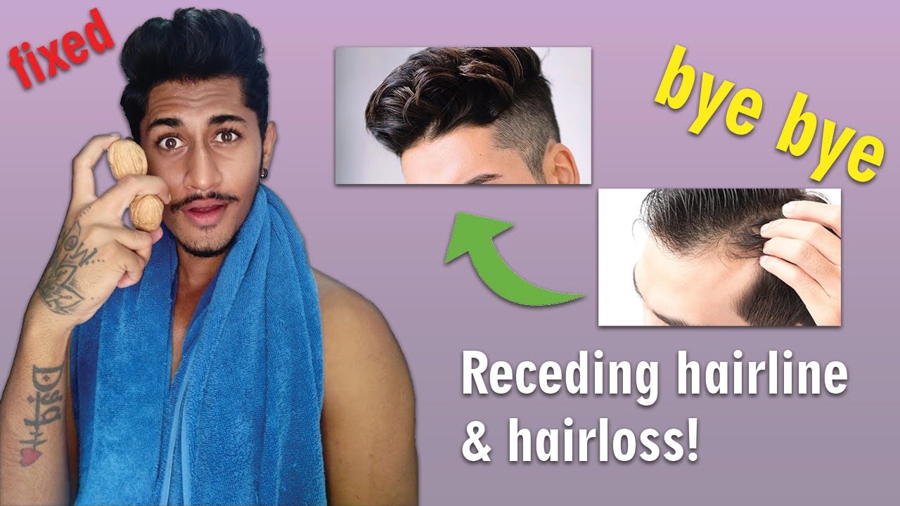 STOP! Receding Hairline And Hairfall | Best Tips Ever | Causes ...