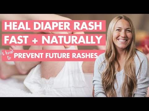 How long does it take for a diaper rash to go away?