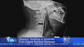 Don't Hold It -- Powerful Sneezes Can Cause Major Damage