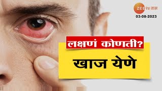 Symptoms of Eye Infection | डोळे येण्याची काय आहेत लक्षणं? कशी घ्याल काळजी?