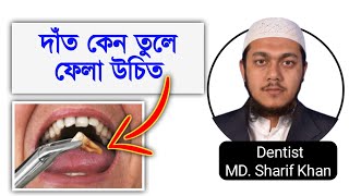 Tooth Extraction || দাঁত কখন তুলবেন || দাঁত তোলার খরচ @DentalHealthTips